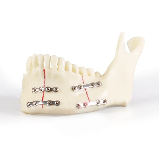 iDENTical Jaw with Titanium Plate Model M5001