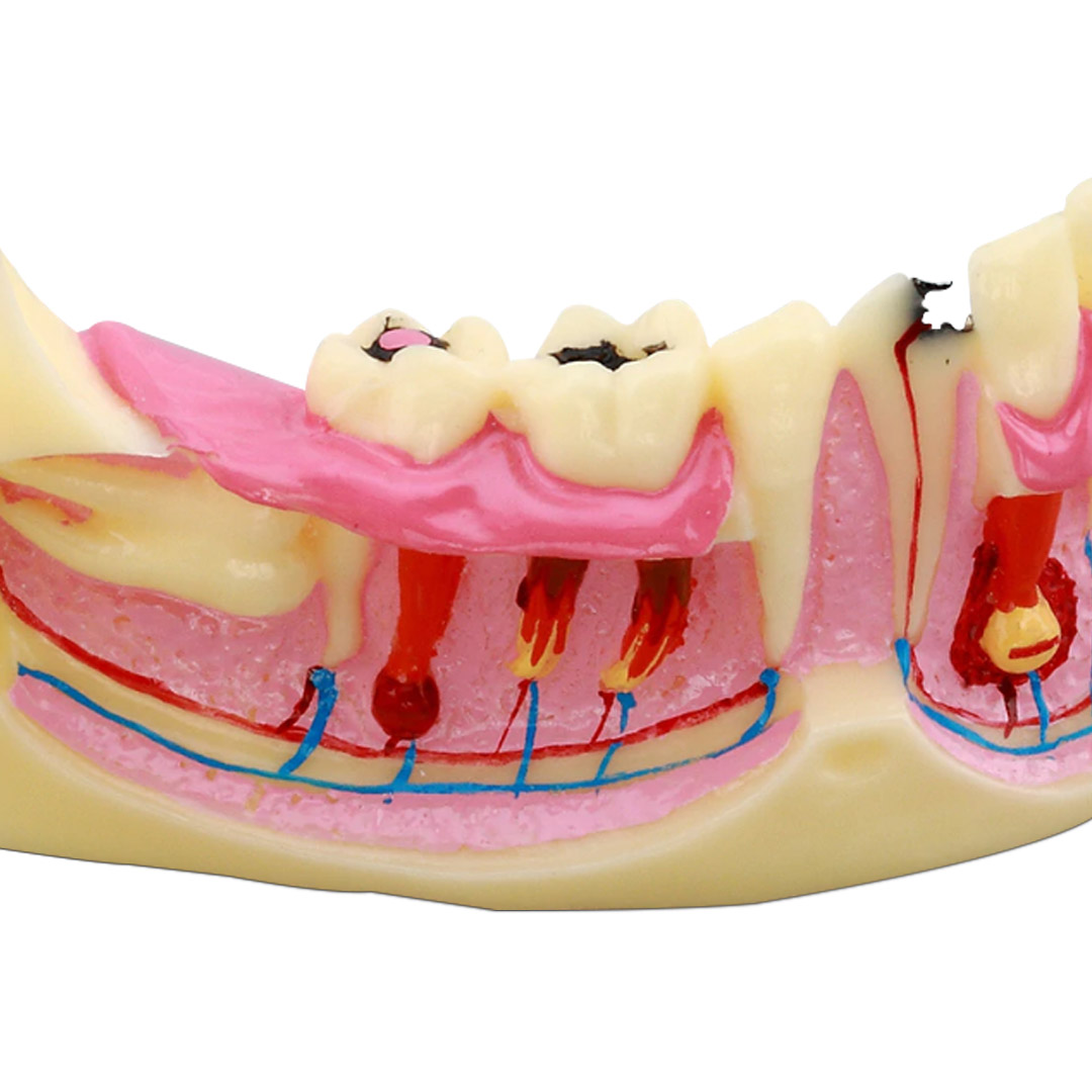 iDENTical Mandible Bone Model M4014
