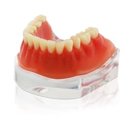 iDENTical Implant Model With Silver Bar M6008