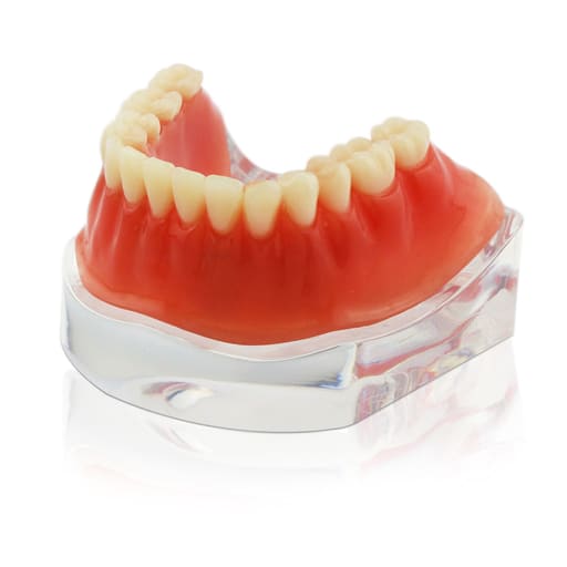iDENTical Implant Model With Silver Bar M6008
