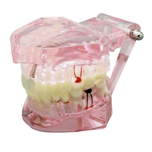 iDENTical All In One Implant Models M2001