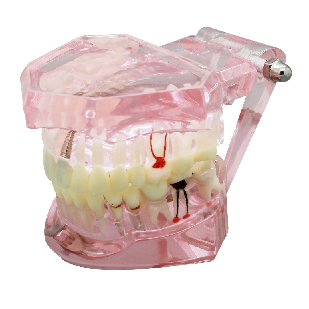 iDENTical All In One Implant Model M2001 -Pink