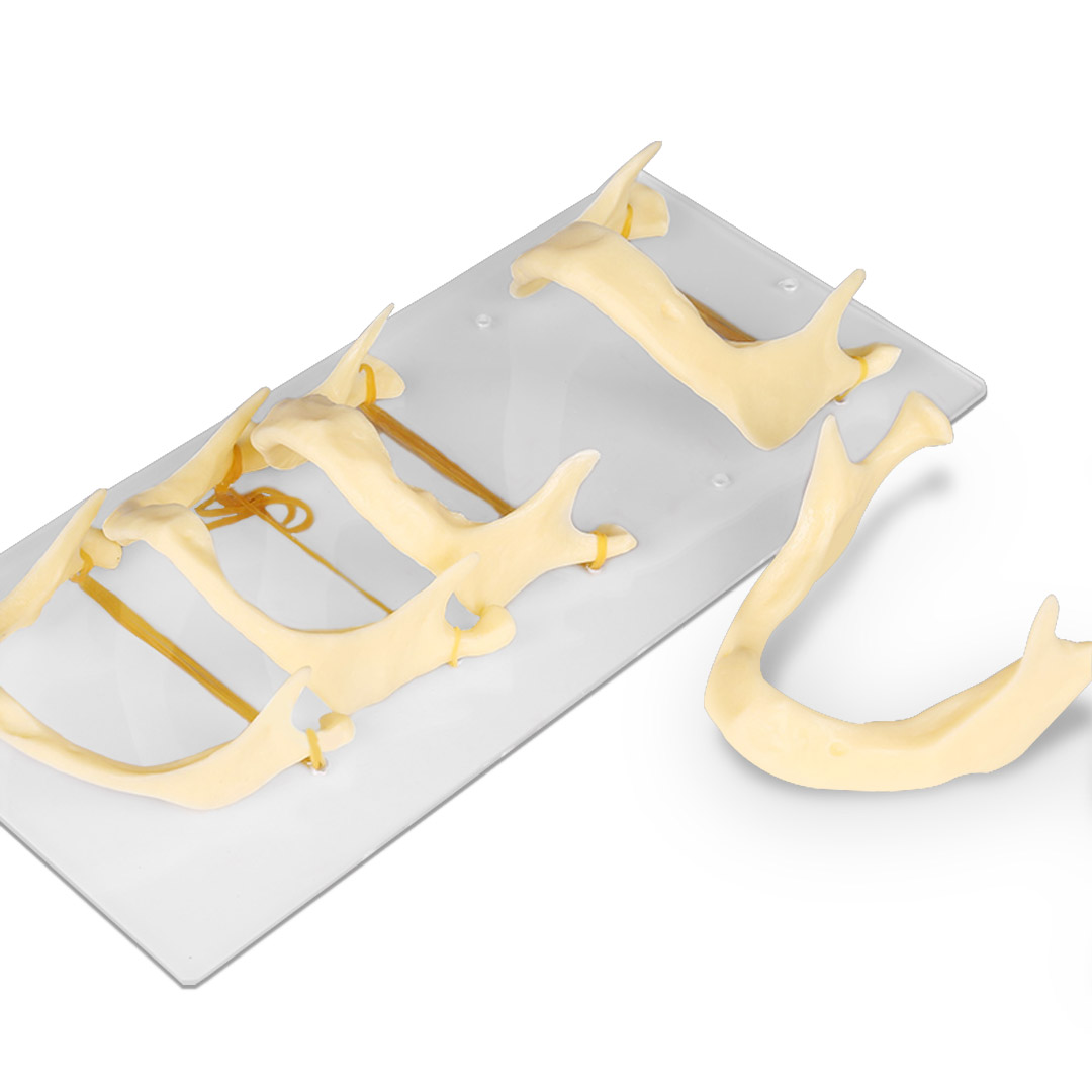 iDENTical The Development of Upper & Lower Jaw Models