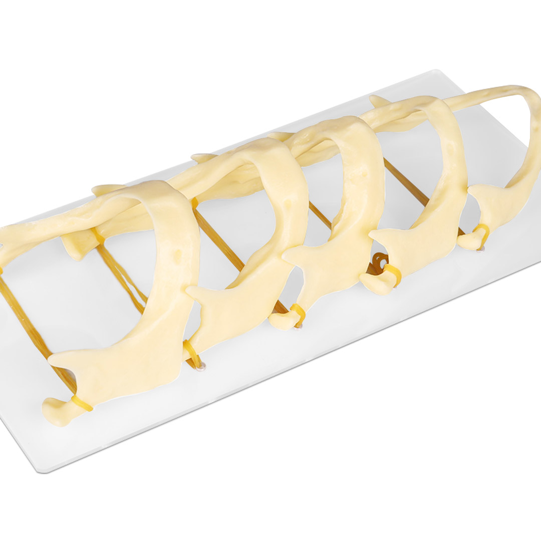 iDENTical The Development of Upper & Lower Jaw Models