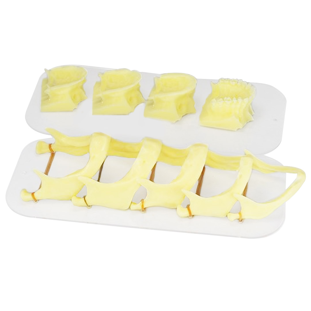 iDENTical The Development of Upper & Lower Jaw Models