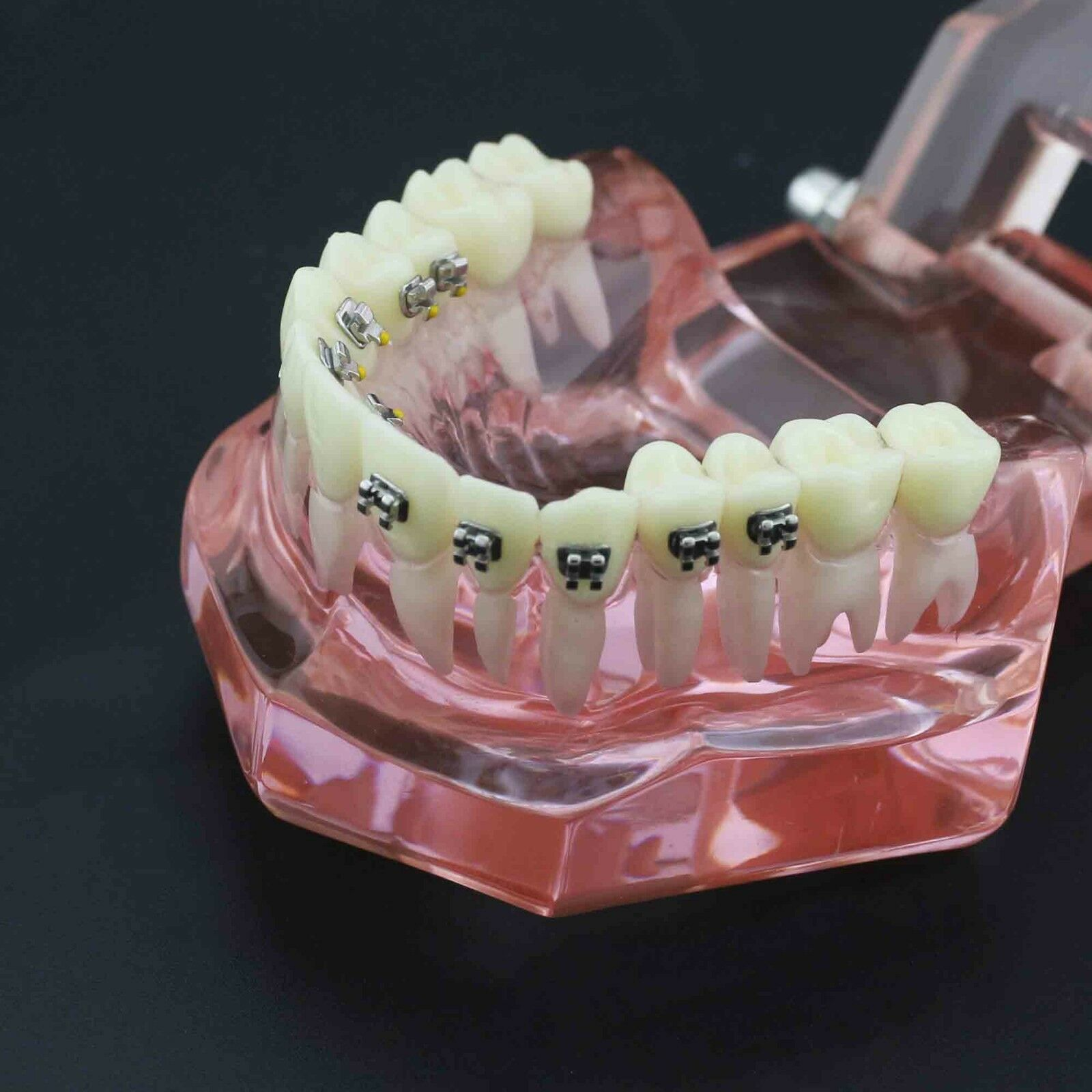 iDENTical Self Ligating Models M3012