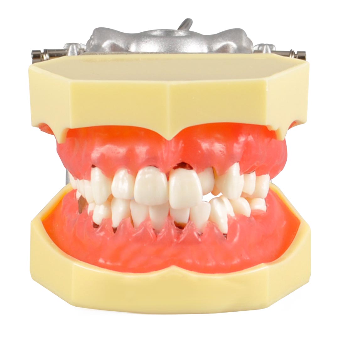 iDENTical Periodontal Model M4003