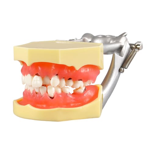 iDENTical Periodontal Model M4003