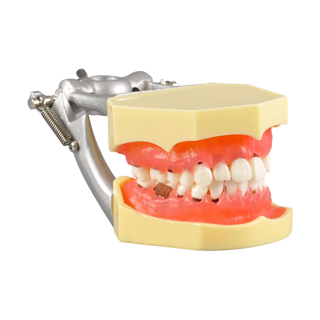 iDENTical Periodontal Model M4003