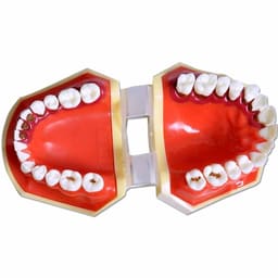 iDENTical Periodontal Disease Model M4025 - 3
