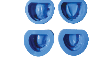 API Model Former - Partially Dentulous