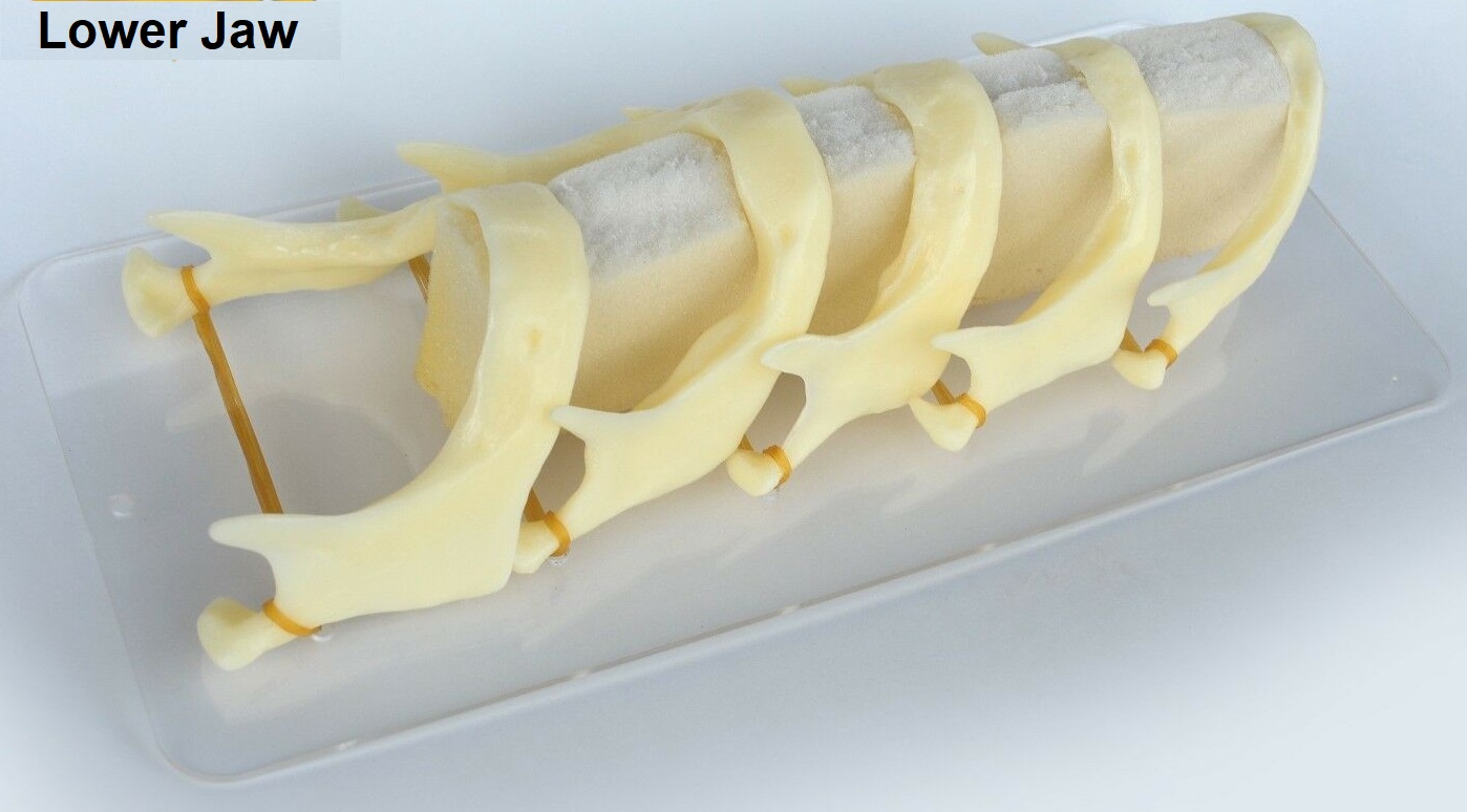 iDENTical The Development of Upper & Lower Jaw Models