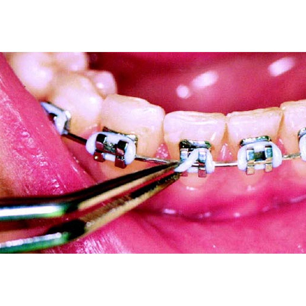 OrthoMetric Elastomerics Modular Ligatures