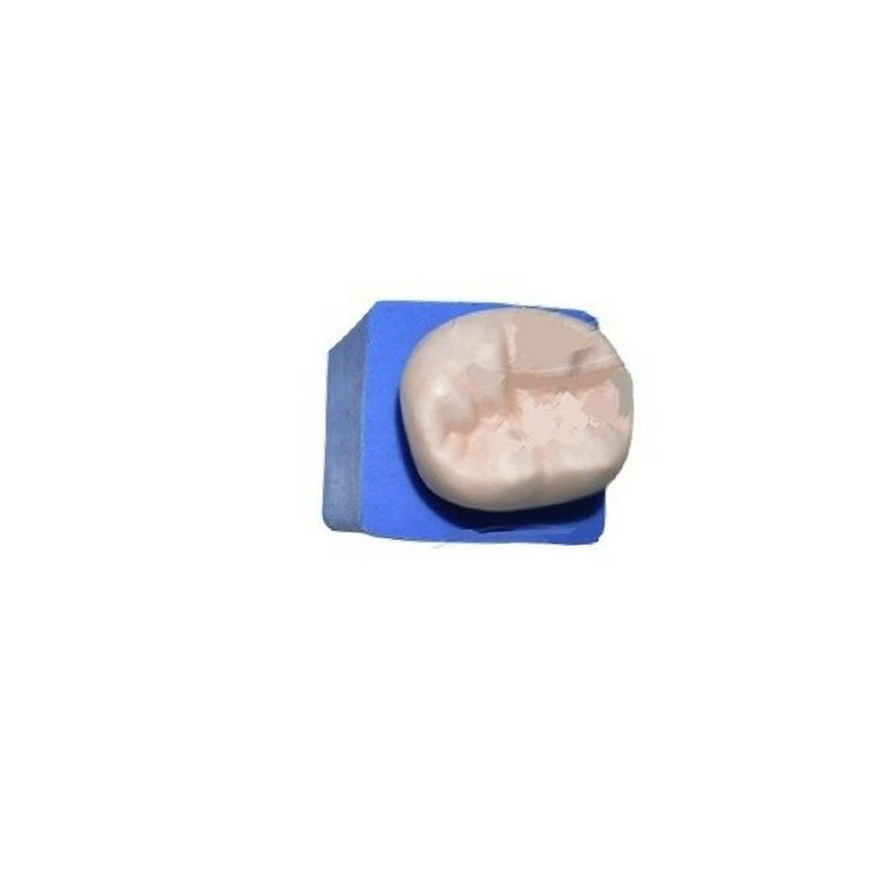 API Model Former - Teeth Enlarger # Lower Molar