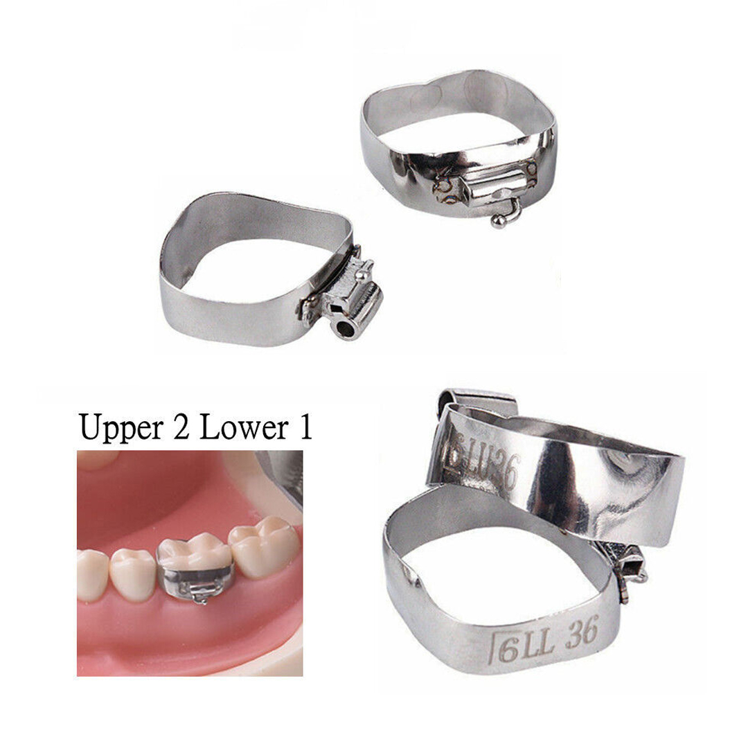 OSL 1st Molar Prewelded Molar Bands MBT 0.022 U2/L1 (Pack Of 4)