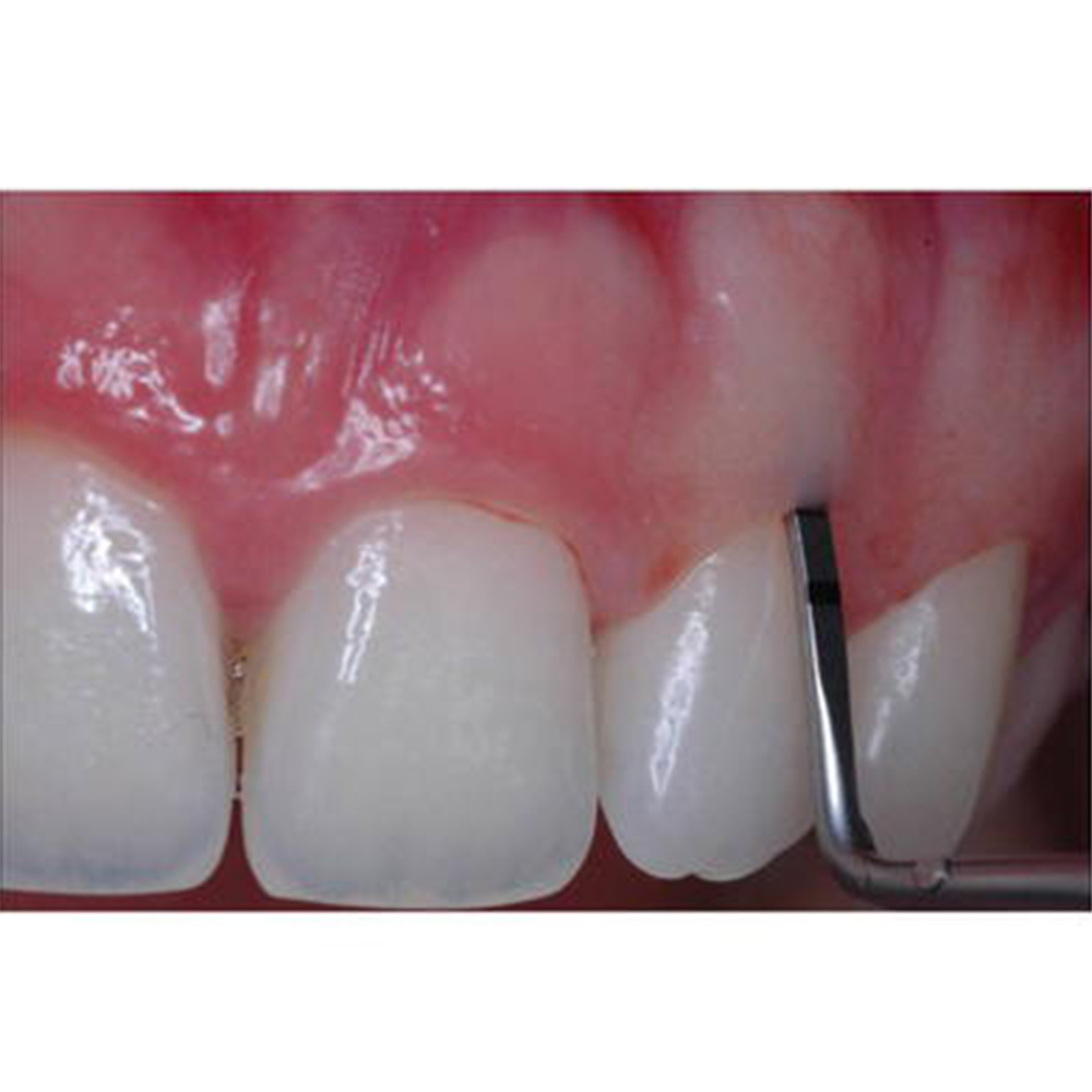 GDC Moon'S Probe P13M