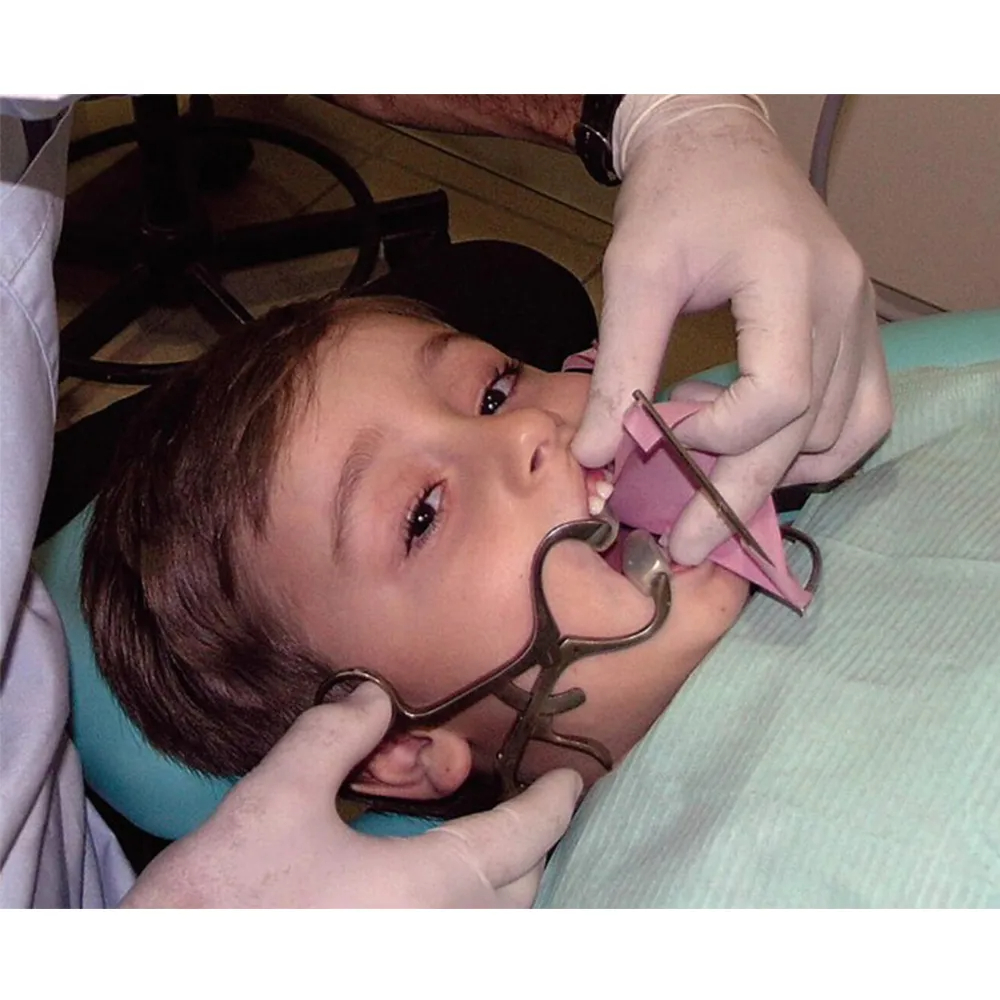 Oracraft Mouth Gag Small (MGC)