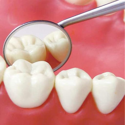 Waldent Mouth Mirror Tops Front Surface Rhodium Coated No.5 Pk/12 (K13/6)