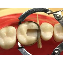 GDC Ivory Retainer (Mri) - 7