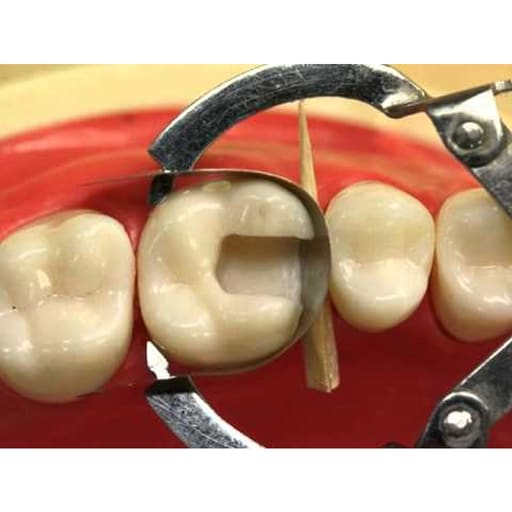 GDC Ivory Retainer (Mri)