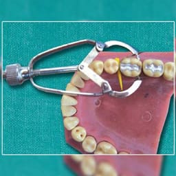GDC Ivory Retainer (Mri) - 6