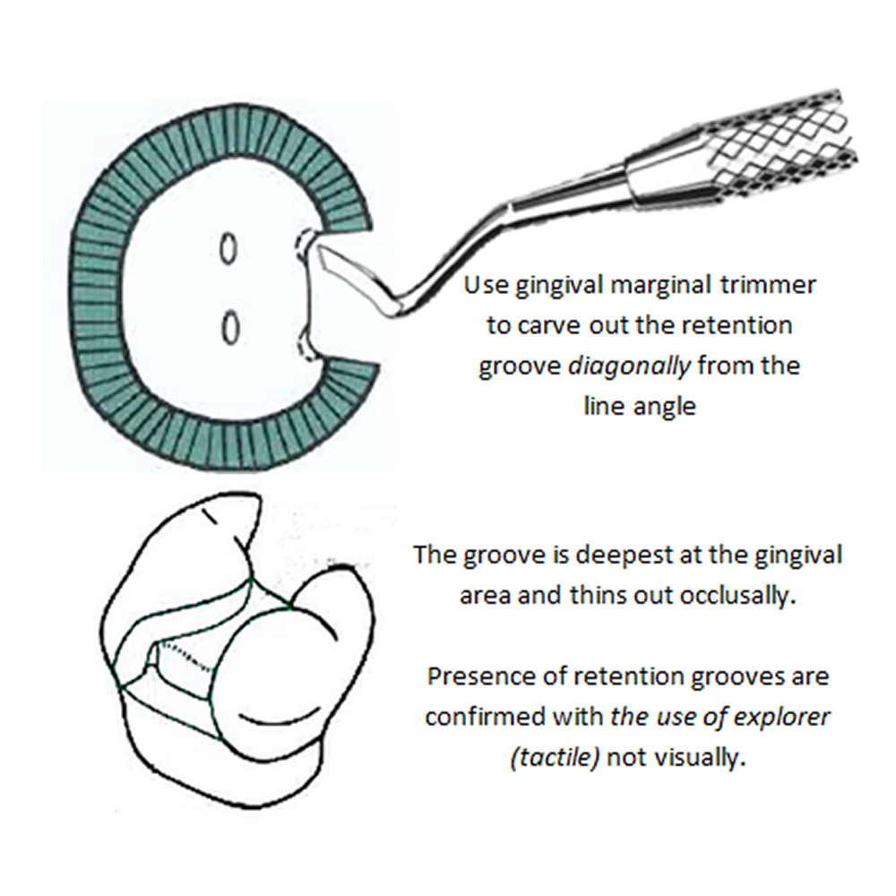 GDC Margin Trimmer - 6 (Mt28h)
