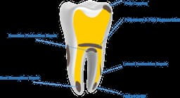 Kids-e-Dental E-MTA (Mineral Trioxide Aggregate) - 4