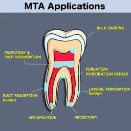 Prime Dental MTA Bio Putty - 4
