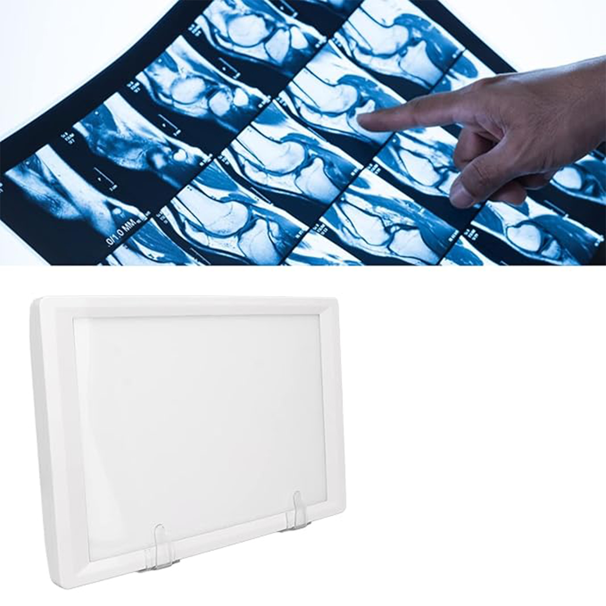 Sparedent Panoramic X-ray Viewer - Chair Mount