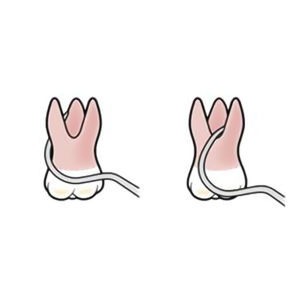 GDC Double End Probes Nabers Color Coded #1 -3 (PQ2N)