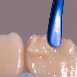 Prime Dental Restorite Nano Hybrid Composite - 7