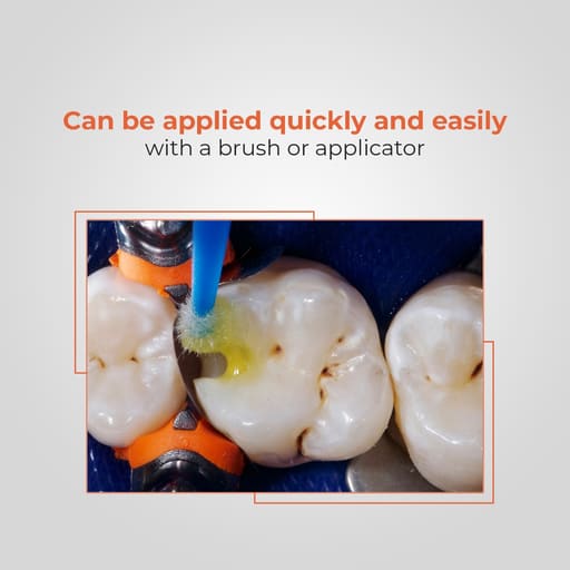 Waldent NanoBond Universal Adhesive