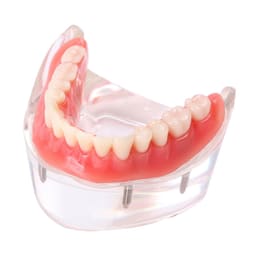 iDENTical Mandibular Overdenture Model with 4 Implants M6003 - 8
