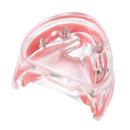 iDENTical Mandibular Overdenture Model with 4 Implants M6003 - 9