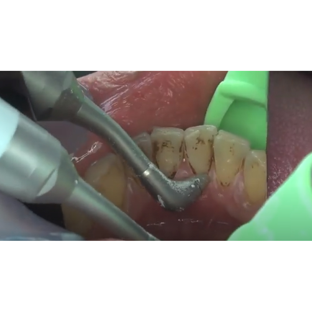 NSK Prophy-Mate Neo Dental Air Polisher PMNG-PTL-P (Y135029)