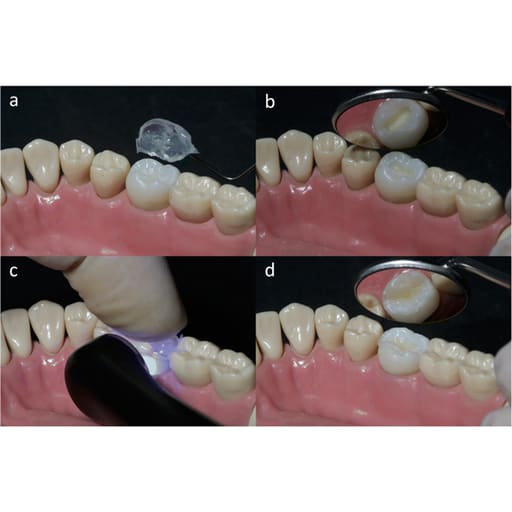 HN Dental Occlu Stamp