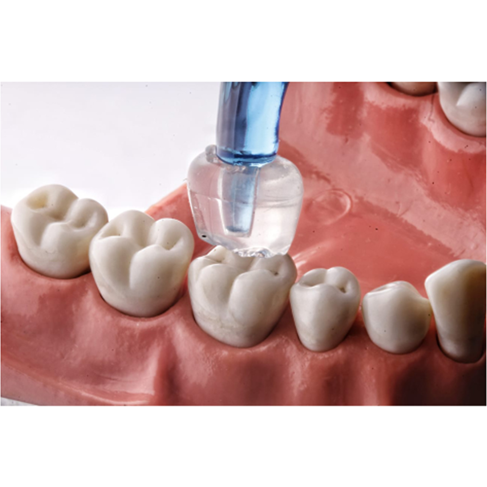 Hn Dental Occlu Stamp