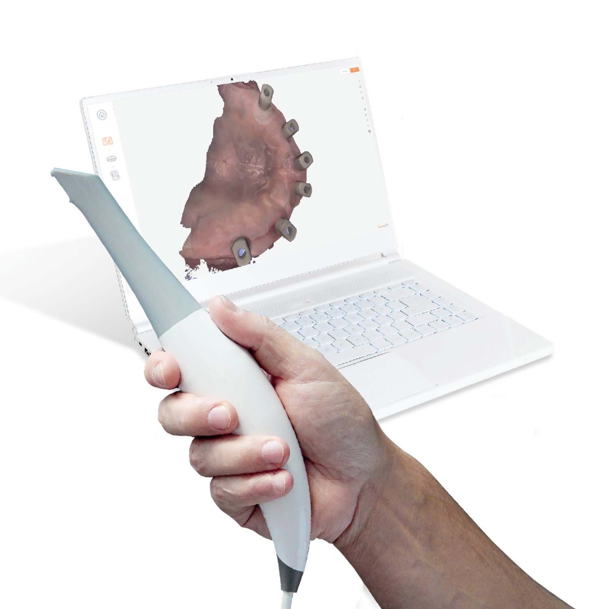 Heron Intraoral Scanner