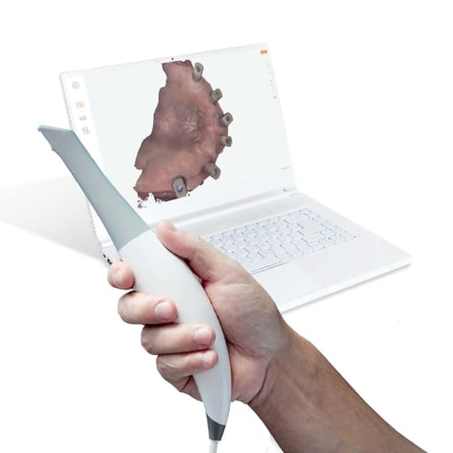 Heron Intraoral Scanner