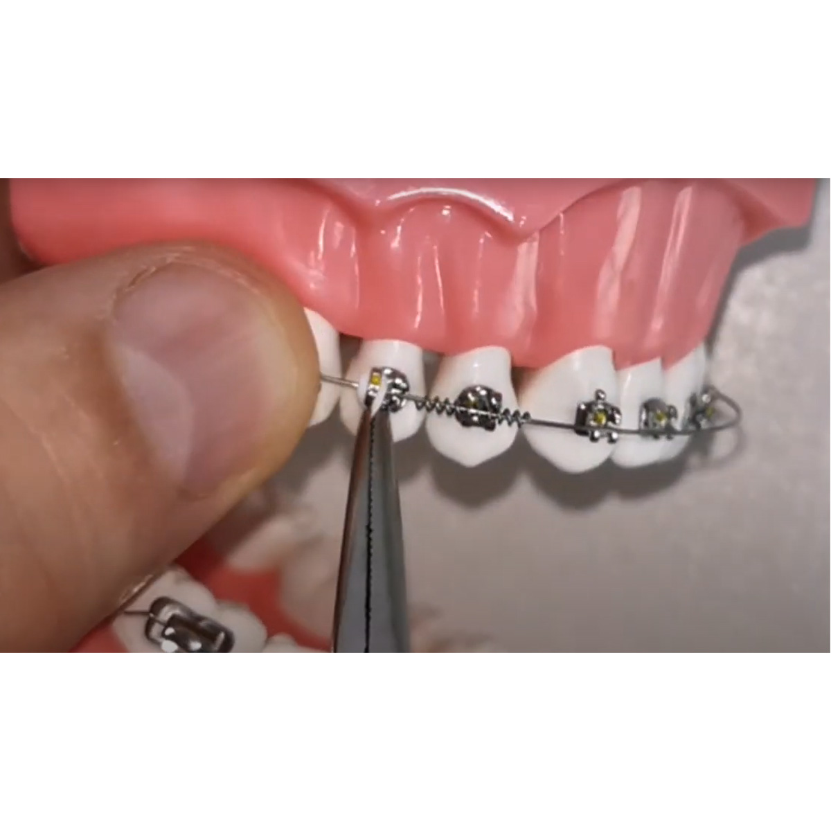 JJ Ortho NiTi Open Coil Spring 180mm (60.01.17)