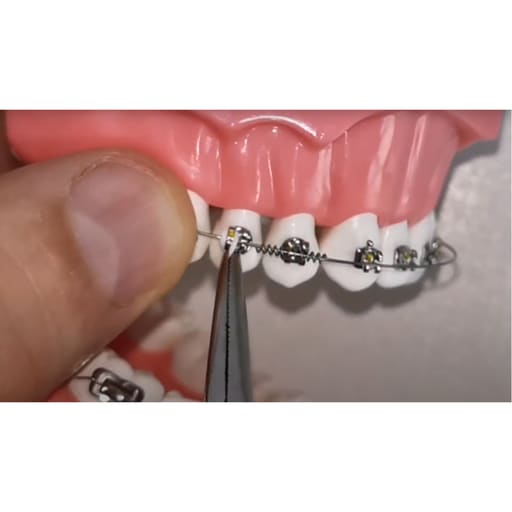 JJ Ortho NiTi Open Coil Spring 180mm (60.01.17)