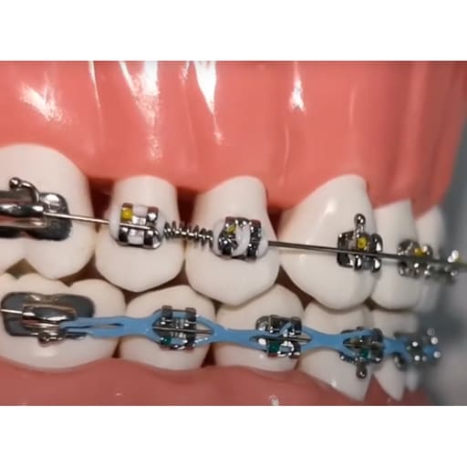 JJ Ortho NiTi Open Coil Spring 180mm (60.01.17)