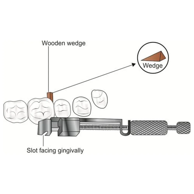 Oracraft Tofflemire Matrix Retainer - MRTU