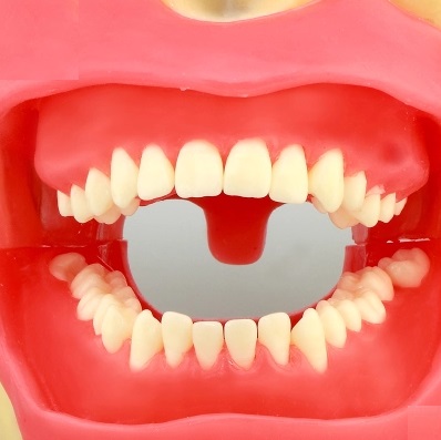 iDENTical Oral Local Anaesthesia Training Model M8020