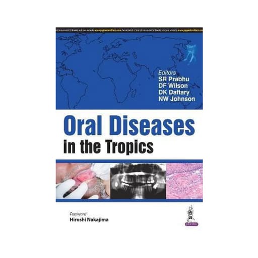 Jaypee Medical Oral Diseases in the Tropics (ISBN - 150554)