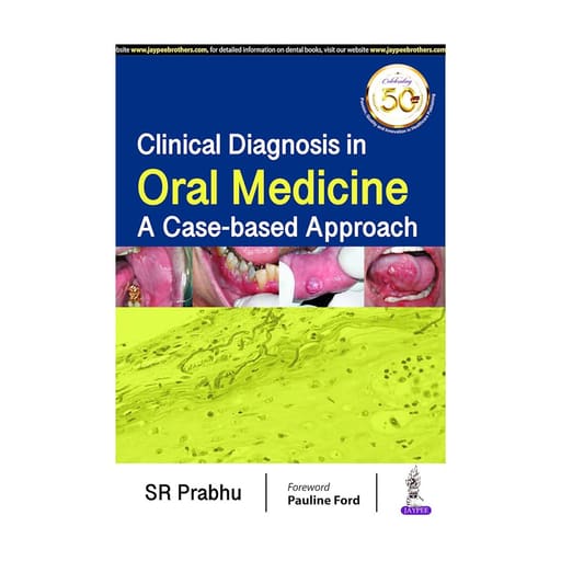 Jaypee Medical Clinical Diagnosis in Oral Medicine: A Case-based Approach (ISBN - 706068)