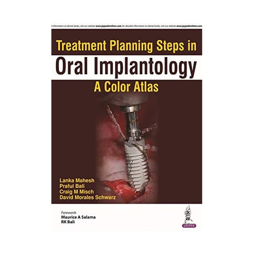 Jaypee Medical Treatment Planning Steps in Oral Implantology: A Color Atlas (ISBN - 700592)
