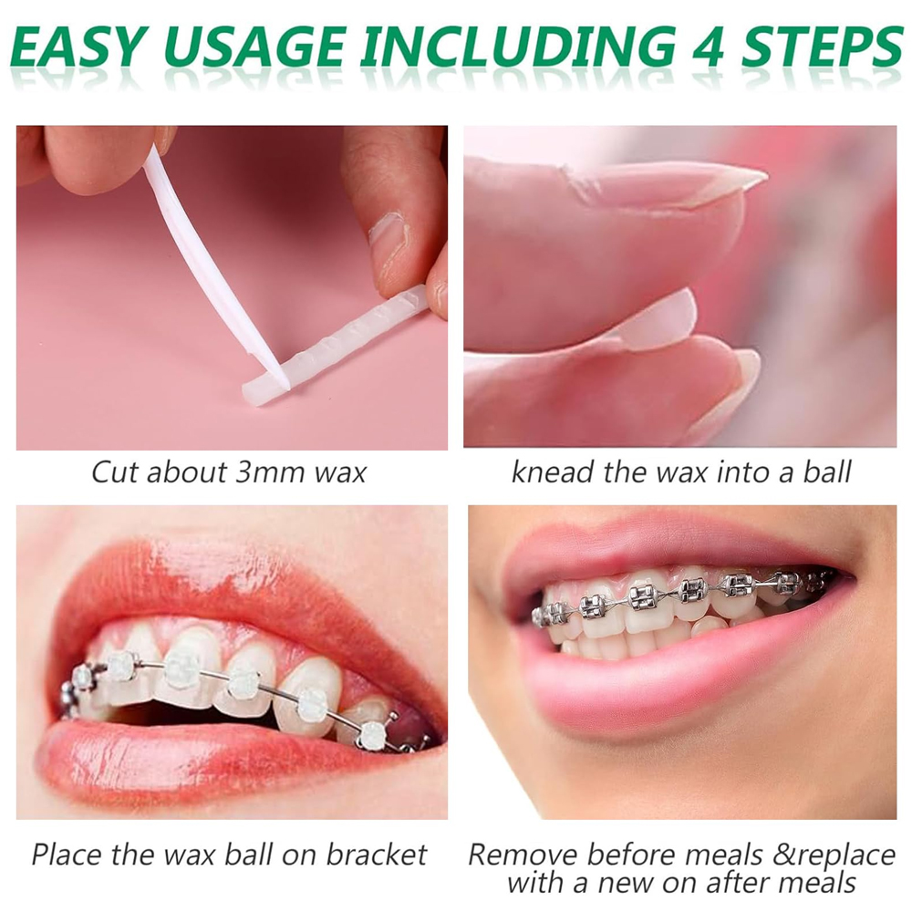 U Ortho Orthodontic Relief Wax (Pack of 10)