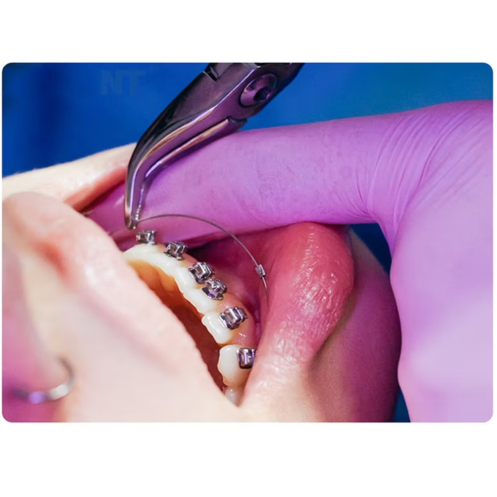 Orthodent Preformed Copper Niti SL Archwires Rectangular With Stops (Pack of 10)