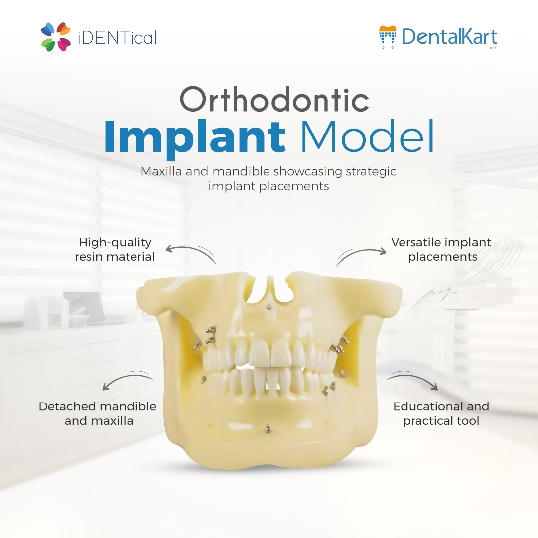 iDENTical Orthodontic Implant Model - M2016